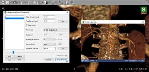 radiant fmovie|RadiAnt DICOM Viewer.
